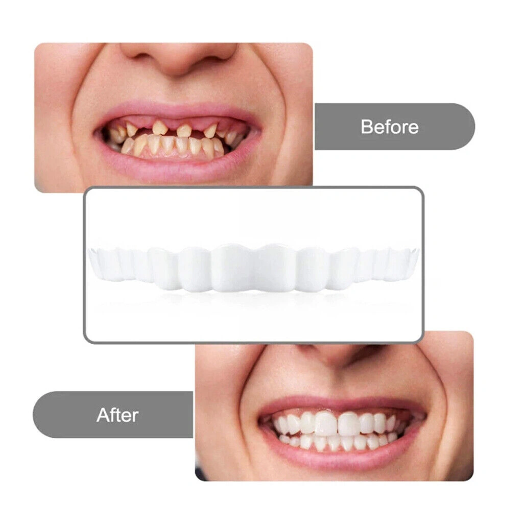 False Teeth Denture Prossthesis - Realistic Cosmetic Dentures, Removable Artificial Teeth Set, Dental Prosthesis view 5